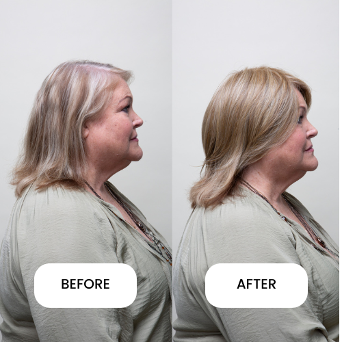 Clio 8 L | Glam Topper