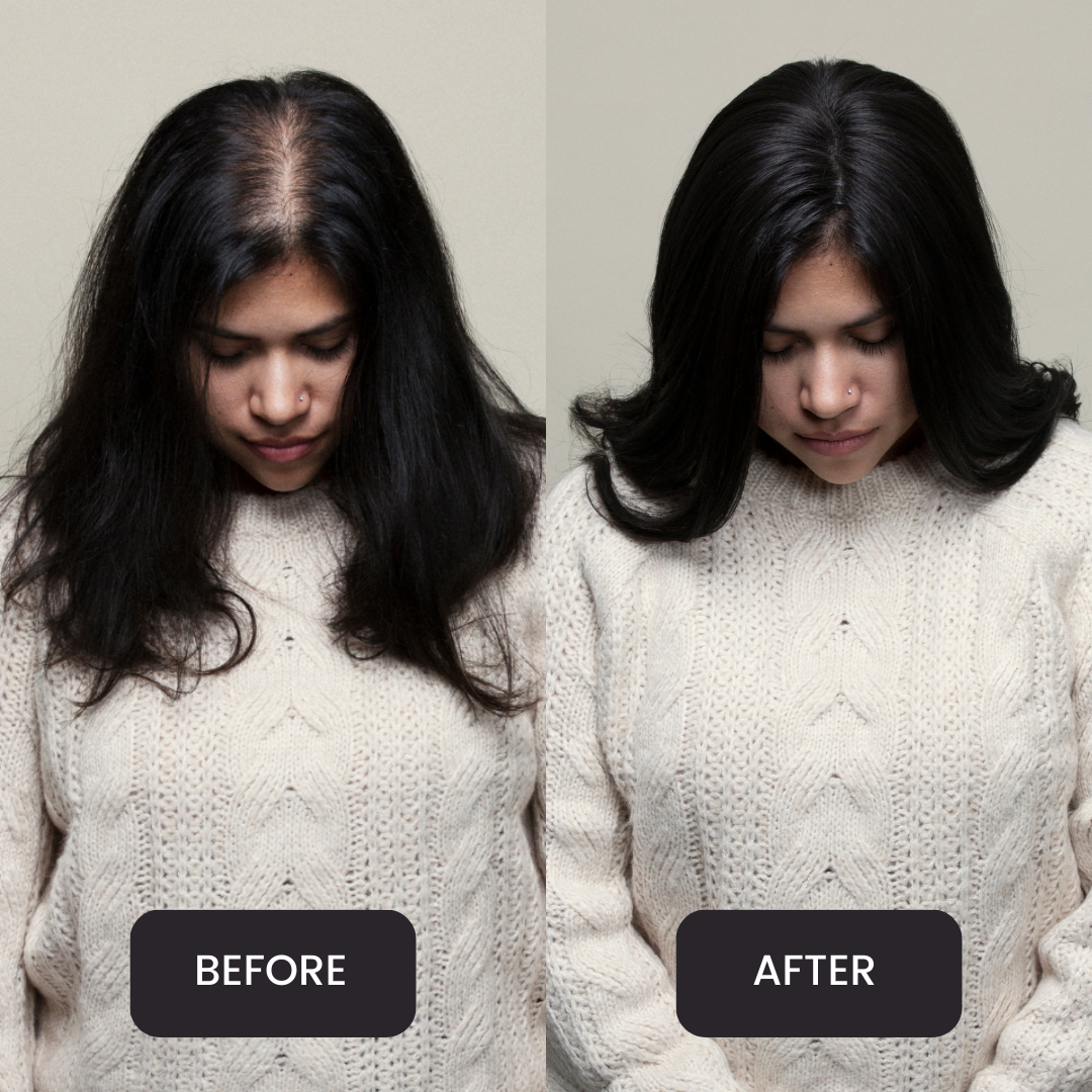 Clio 14 L | Glam Topper