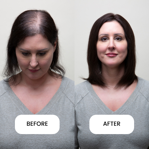 Clio 12 L | Luxury Topper